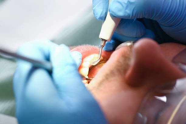 Best Tooth Infection Emergency Dentist  in Port St John, FL